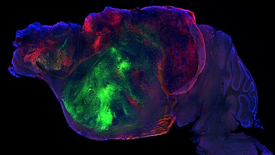 Científicos injertan neuronas humanas en ratones sin corteza cerebral y recuperan sus capacidades