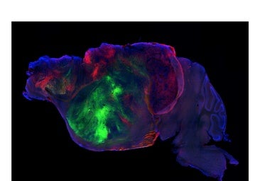 Injertan neuronas humanas en ratones sin corteza cerebral y recuperan sus capacidades