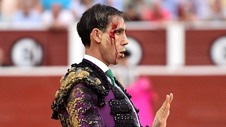 Fortes, con arena y heridas en la frente, tras la voltereta