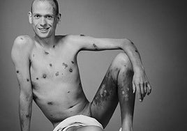 Fotografía de una campaña de concienciación con los enfermos de sida de Erwin Olaf de 1995