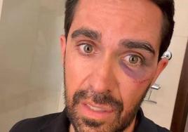 Alberto Contador sufre una aparatosa caída en China: «Son imágenes muy duras»