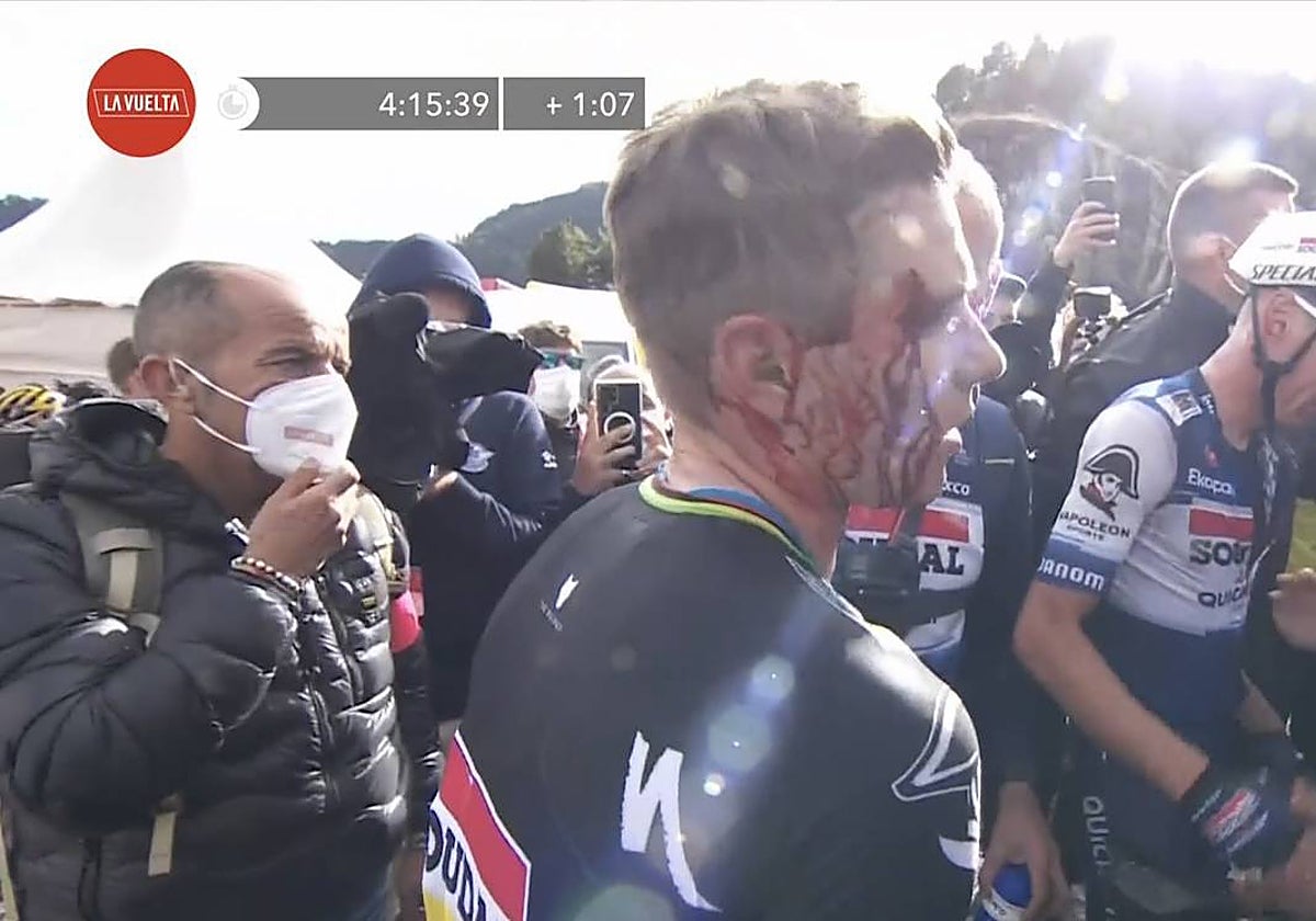 Remco Evenepoel, ensangrentado