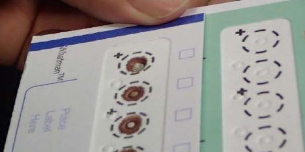 La gota de sangre seca revoluciona los controles de dopaje