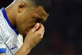 Mbappé finalmente tendrá que pasar por quirófano para operarse la nariz