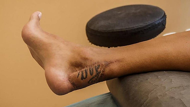 Cazorla llevará para siempre la imborrable huella de las lesiones en forma de espeluznante cicatriz