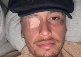 El ex del Sevilla FC Lucas Ocampos sufre una parálisis facial