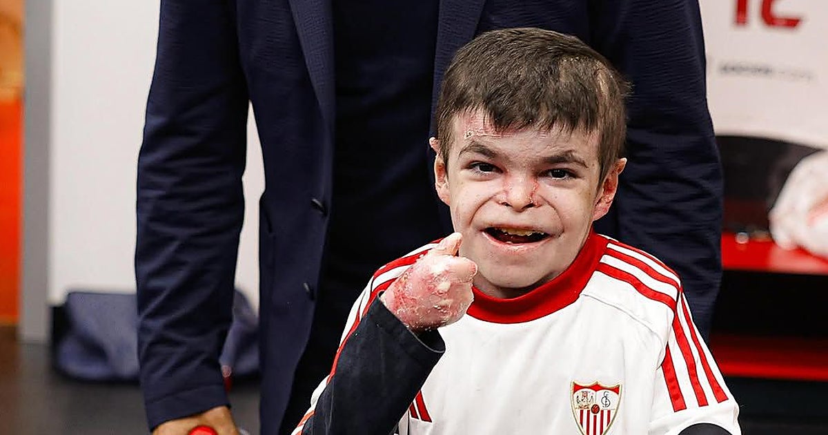 Leo, el niño con Piel de Mariposa, disfrutó de la victoria del Sevilla FC ante el Atlético