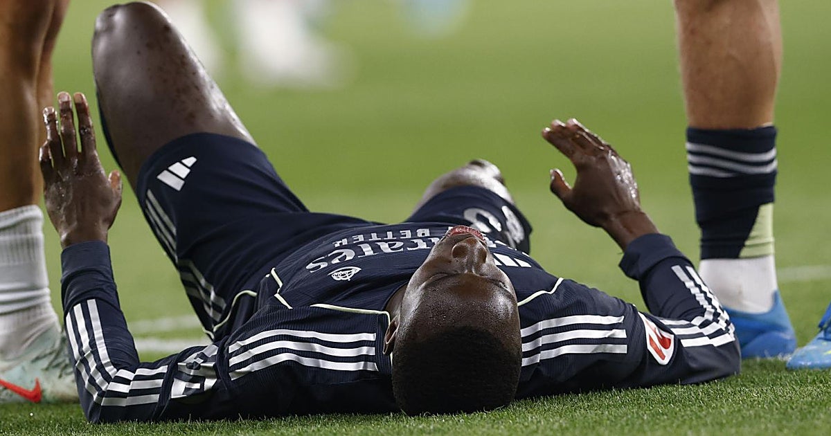 Otra mazazo para el Madrid: Mendy tiene una lesión gravísima y podría retirarse