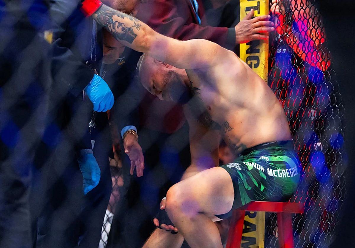 Conor McGregor tendrá que pasar por quirófano tras la lesión sufrida frente a Max Holloway