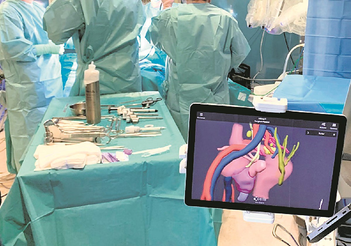 Modelo 3D en quirófano, desarrollado por la empresa española Cella