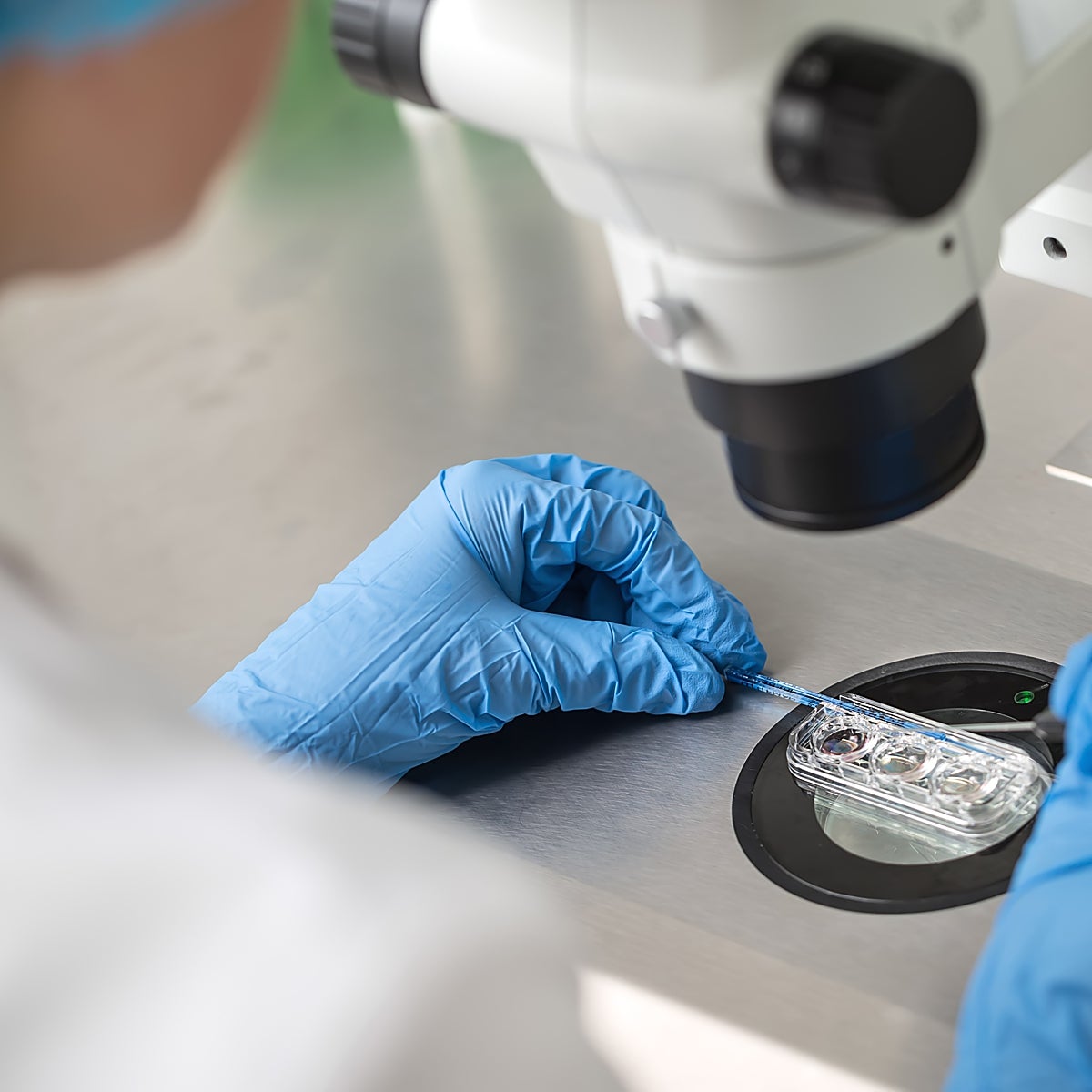 Seis nuevos casos de viruela del mono en Castilla y León, que acumula ya 19 positivos