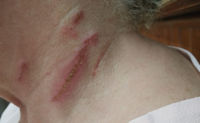 Una médico agredida en Camarena (Toledo): «Hasta que no perdí la consciencia, no me dejaron de golpear»