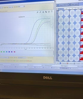 Imagen secundaria 2 - El grupo de investigadores, que lleva un largo tiempo perfeccionando sus métodos, prevé que la prueba de concepto que realiza en el Hospital Puerta de Hierro arroje sus primeros resultados para principios de 2023.