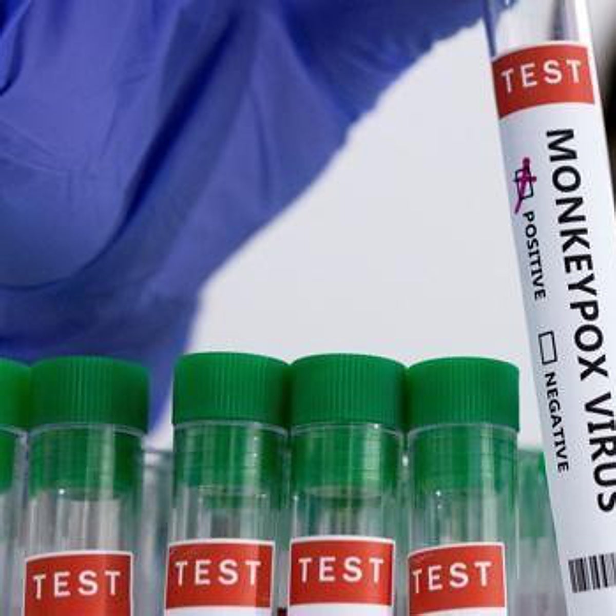 Sanidad pone 13 de las 163 vacunas de viruela del mono recibidas