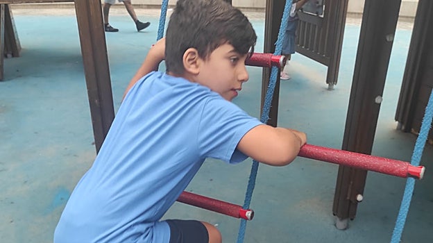 Aray tiene una deleción completa de un gen, que tiene una incidencia de un 5% dentro de una enfermedad rara