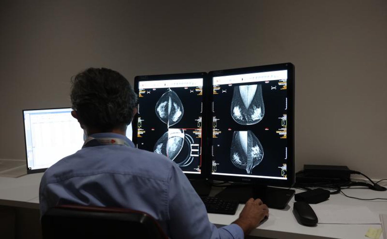 Alerta ante el aumento de casos de cáncer de mama en hombres: estos son los síntomas