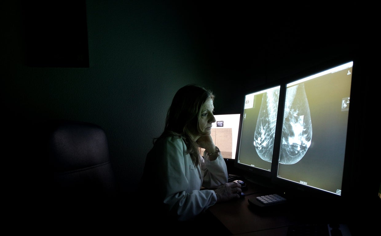 Una doctora consulta la imagen de un seno