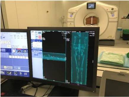 Monitores de control del sistema de captación de la tomografía y el dispositivo en el que está el féretro de san Isidro