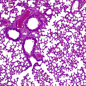 Crean una 'píldora viva' que combate la resistencia a los antibióticos en las infecciones pulmonares