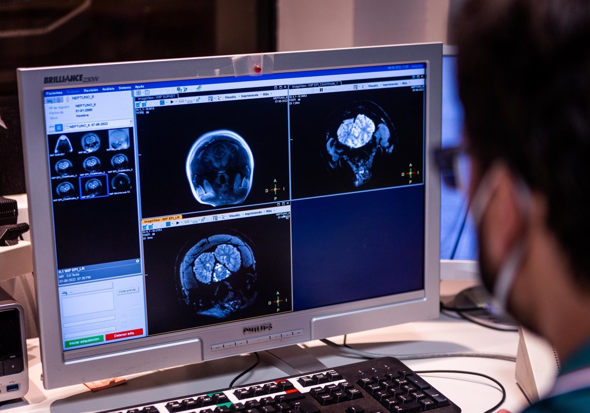 Imagen de un ordenador con imágenes médicas en el centro de datos de la Fe de Valencia