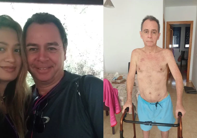 «Pasé 62 días en coma y estuve a punto de morir»: calvario en la sanidad pública valenciana por una apendicitis