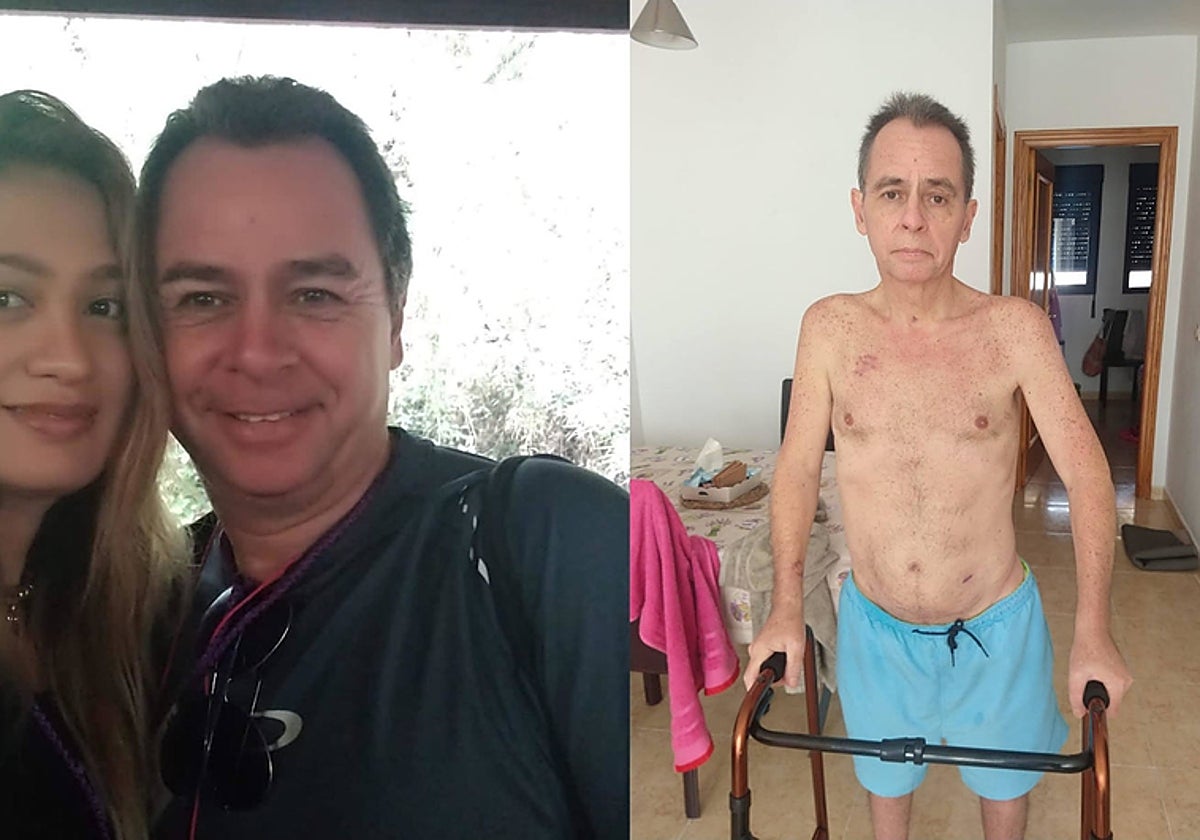 Gustavo Maestre, antes y después su hospitalización de tres meses por la apendicitis no diagnosticada.