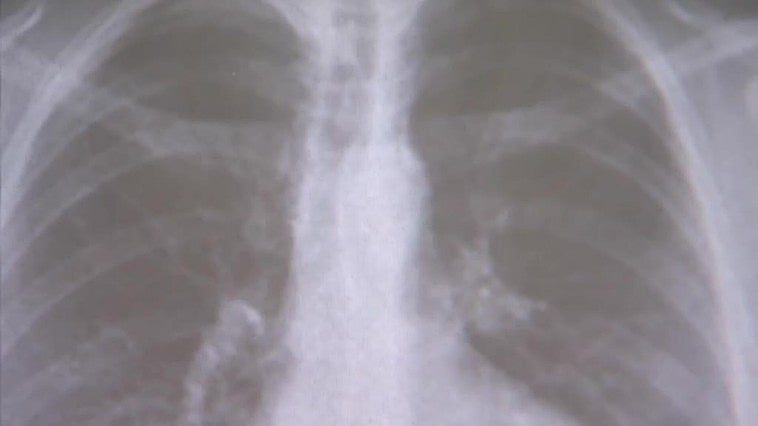 "Vapear es la puerta de entrada para el tabaco en los adolescentes"