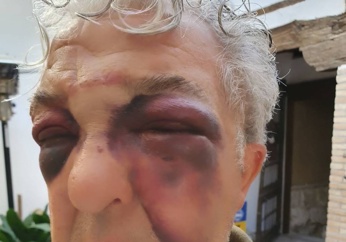 José Luis Fernández de Rojas tras la paliza