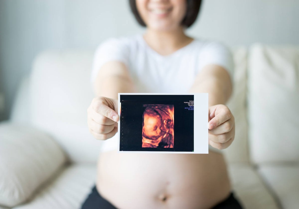 Una embarazada muestra la imagen del feto obtenida mediante una ecografía