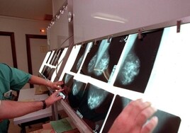 Un centenar de ginecólogos oncólogos analizarán en Valladolid los tratamientos menos agresivos contra el cáncer