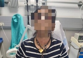Prisión para el presunto agresor de la mujer  maniatada con una cadena de manos a cuello en Miranda