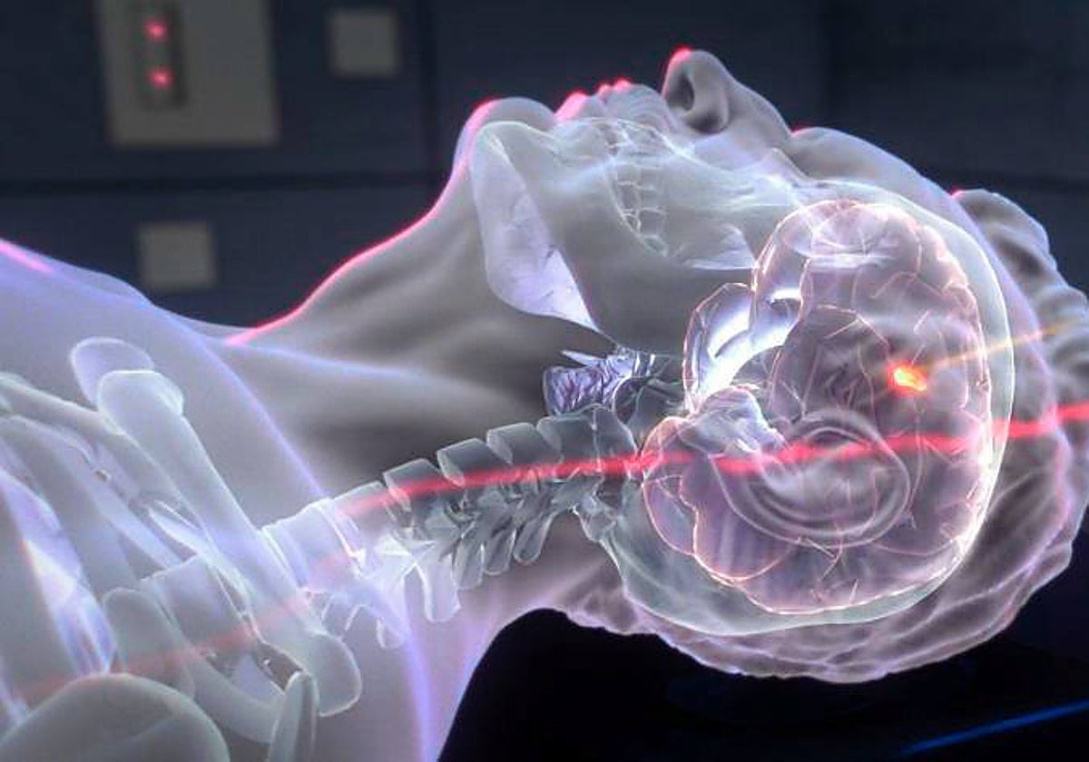 Imagen del tratamiento por haces de iones cedida por CSIC