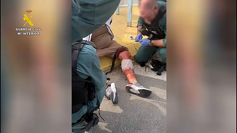 Imagen del hombre herido por arma blanca en el gemelo izquierdo