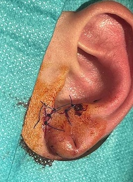 Imagen - Lesiones sufridas por el menor agredido. Abajo, Ciudad de la Justicia de Vigo