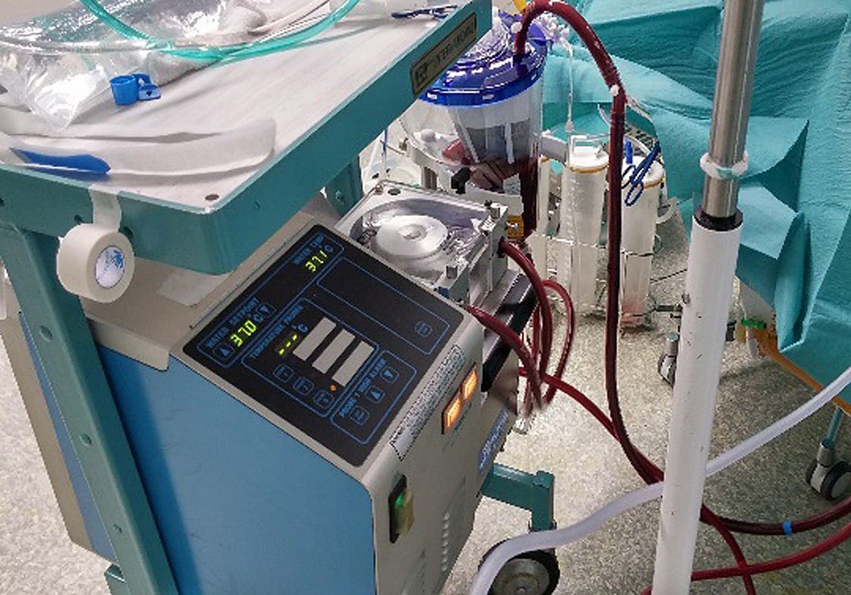 Máquina para mantener en buen estado órganos destinados a la donación