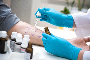 Un alergólogo, en pleno desarrollo de un test cutáneo