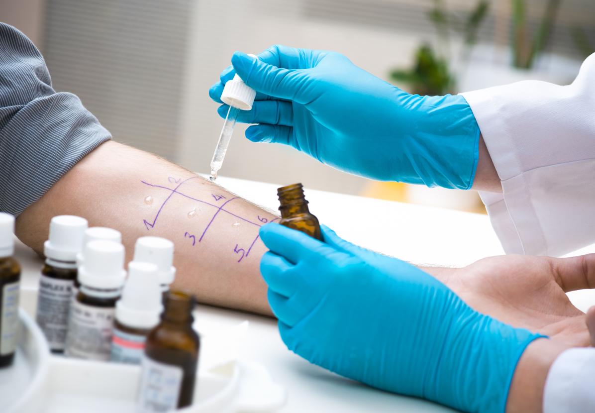 Un alergólogo, en pleno desarrollo de un test cutáneo