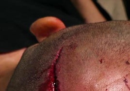 Mossos heridos en Lérida: «Los apalearon con barras de hierro»