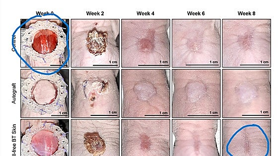 Científicos de Granada diseñan un biogel que acelera la cicatrización de las heridas en la piel