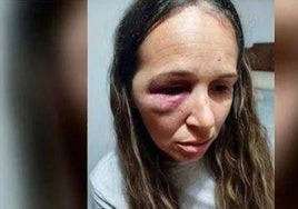 A prisión cuatro okupas por propinar una brutal paliza a una embarazada y a su pareja en Bujalance: «Me dejaron inconsciente»