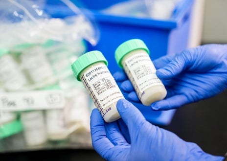 Imagen secundaria 1 - Una vez recibido el alimento en el hospital, al que llega conservado en frío, se deriva al Centro de Hemoterapia y Hemodonación, encargado de analizar, procesar y almacenar la leche materna para entregar a bebés que lo requieran