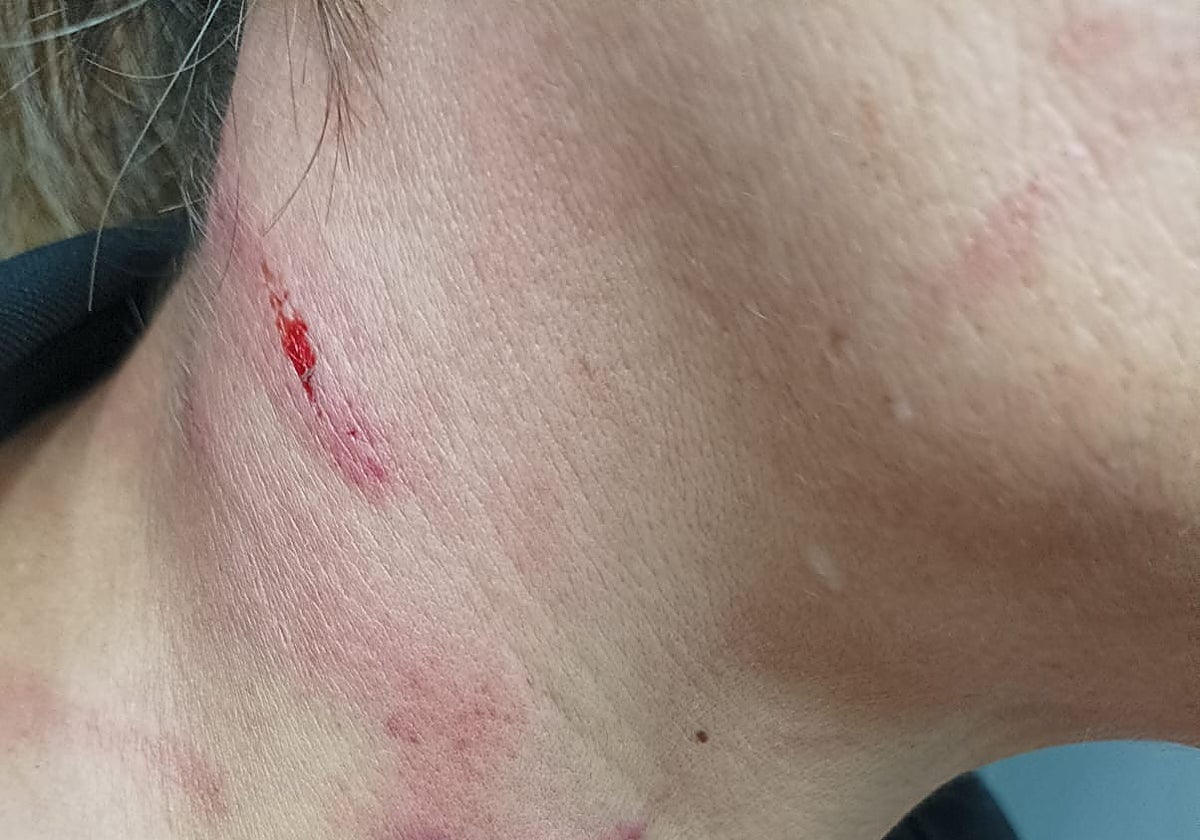 Imagen de la trabajadora de la cárcel de Picassent, brutalmente agredida por una reclusa