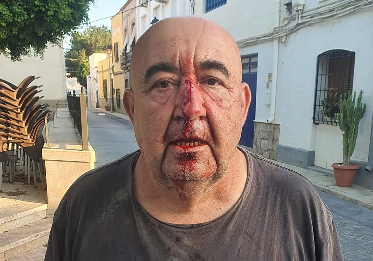 Concejal de Medio Ambiente de Alsodux, José Manuel Gil, tras sufrir la agresión