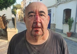 Agreden con una piedra a un concejal de un pueblo de Almería y le rompen la nariz mientras conducía