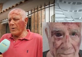 La Guardia Civil investiga una brutal paliza de un grupo de jóvenes a un vecino de Torre Pacheco (Murcia)