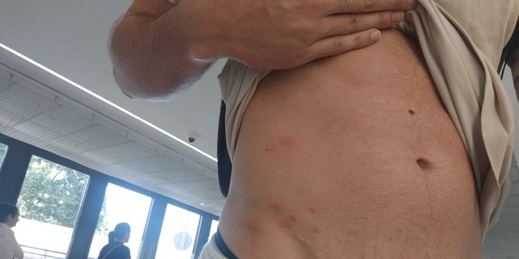 La Policía fumiga las chinches de la comisaría del aeropuerto de Barajas después de que AENA se negara