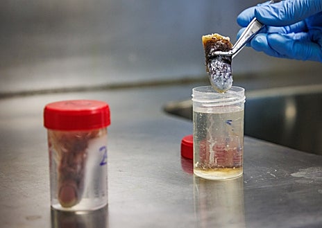 Imagen secundaria 1 - Arriba, Laura, policía y bióloga, aplica una luz especial para revelar vestigios. Abajo, a la izquierda, proceso de ósmosis para recuperar la huella del dedo de un fallecido. A la derecha, comparación de varias huellas dactilares 