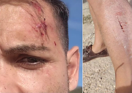 Dos periodistas de la televisión valenciana sufren una paliza a manos de varios ganaderos