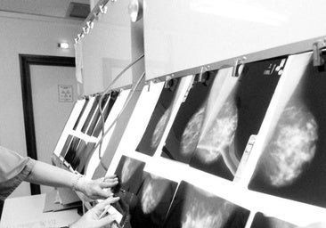 La Junta de Page admite que hay unas 3.000 mujeres a la espera de mamografía