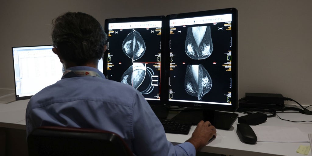 La Junta pagará casi el doble por las mamografías tras el parón del cribado en Talavera de la Reina